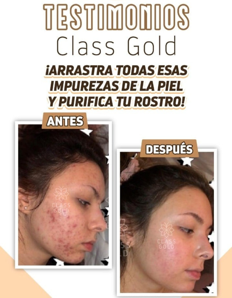 Imagen Tonico Aclarante Facial Class Gold 2